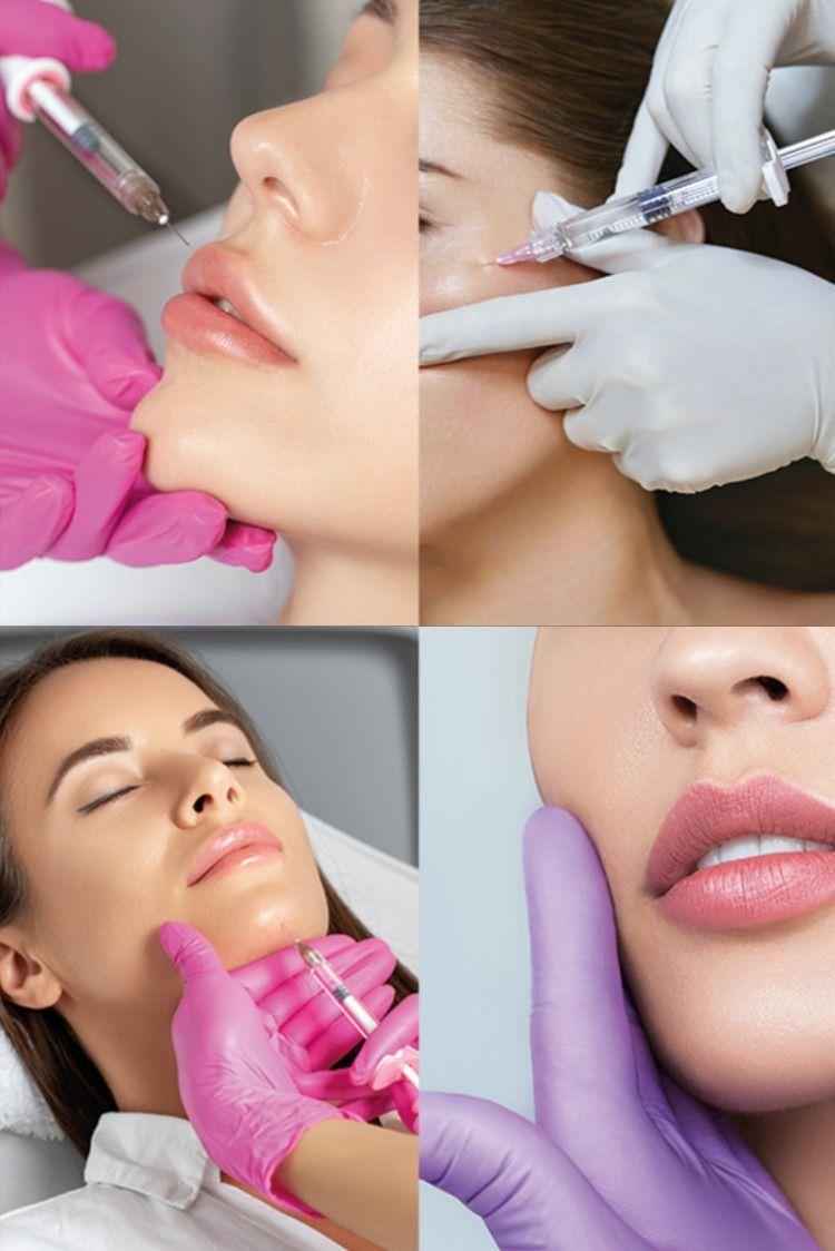 Lip Fillers treatment